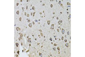 Immunohistochemistry of paraffin-embedded mouse brain using FGF2 antibody (ABIN5970065) at dilution of 1/100 (40x lens). (FGF2 antibody  (N-Term))
