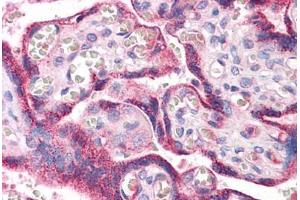 Human Placenta: Formalin-Fixed, Paraffin-Embedded (FFPE) (RYBP antibody  (AA 71-120))