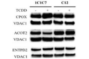 Western blot analysis of differentially expressed proteins identified by SILAC in hepatoma 1c1c7 and c12 cells exposed to DMSO or TCDD Source: PMID27105554 (ENTPD2 antibody  (AA 401-495))