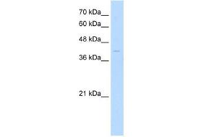 Human Jurkat; WB Suggested Anti-MKX Antibody Titration: 0. (MKX antibody  (Middle Region))