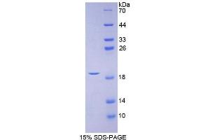 SDS-PAGE (SDS) image for Calcitonin-Related Polypeptide alpha (CALCA) (AA 1-127) protein (His tag) (ABIN2120701)