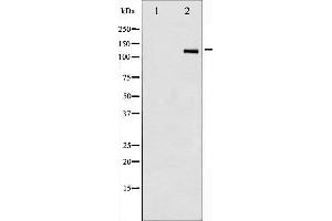 Western blot analysis of HDAC6 phosphorylation expression in NIH-3T3 whole cell lysates,The lane on the left is treated with the antigen-specific peptide. (HDAC6 antibody  (pSer22))