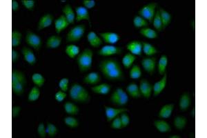 Immunofluorescence staining of Hela cells with ABIN7149243 at 1:133, counter-stained with DAPI. (CYP2C19 antibody  (AA 245-353))