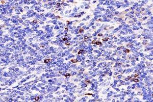Immunohistochemistry analysis of paraffin-embedded human tonsil using,TCRb (ABIN7075813) at dilution of 1: 1800 (TCRb antibody)