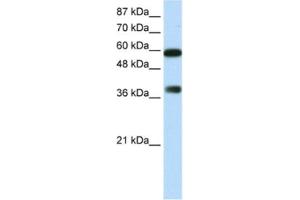 Western Blotting (WB) image for anti-AT Rich Interactive Domain 3B (BRIGHT-Like) (ARID3B) antibody (ABIN2461791) (ARID3B antibody)