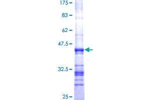 NEK2 Protein (AA 331-445) (GST tag)