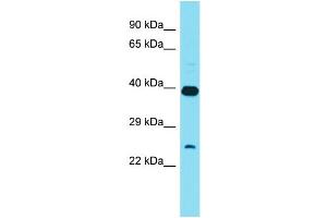 Host: Rabbit Target Name: XRCC6BP1 Sample Type: HT1080 Whole Cell lysates Antibody Dilution: 1.