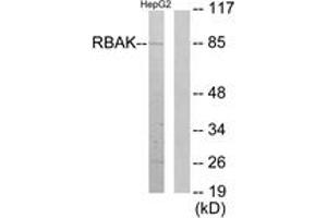 Western blot analysis of extracts from HepG2 cells, using RBAK Antibody.