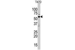 Western blot analysis of MAPK15 polyclonal antibody  in T-47D cell line lysates (35 ug/lane). (MAPK15 antibody  (N-Term))