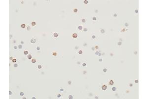Immunocytochemistry (ICC) image for anti-Mitogen-Activated Protein Kinase Kinase 2 (MAP2K2) (AA 1-50) antibody (ABIN7454013) (Recombinant MEK2 antibody  (AA 1-50))