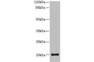Western blot All lanes: PPP3R2 antibody at 9.