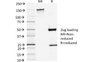 SDS-PAGE Analysis Purified TSH-Receptor, A-Chain Mouse Monoclonal Antibody (TSHRA/1402). (TSH receptor antibody)