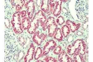 Human Kidney: Formalin-Fixed, Paraffin-Embedded (FFPE) (ANTXR2 antibody)