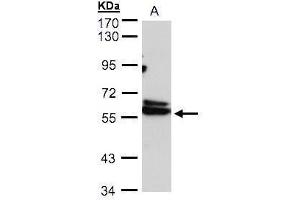 WB Image Sample(30 ug whole cell lysate) A:293T 7. (CCT4 antibody)