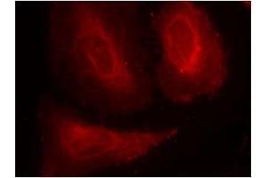 Image no. 3 for anti-3-phosphoinositide Dependent Protein Kinase-1 (PDPK1) (pSer241) antibody (ABIN196616) (PDPK1 antibody  (pSer241))