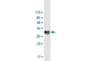 Western Blot detection against Immunogen (34. (OSBP antibody  (AA 324-407))