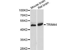 Western blot analysis of extracts of various cells, using TRIM44 antibody.