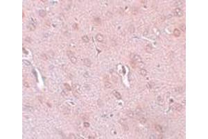Immunohistochemistry (IHC) image for anti-Potassium Channel Subfamily K Member 18 (KCNK18) (Middle Region) antibody (ABIN1031143) (KCNK18 antibody  (Middle Region))