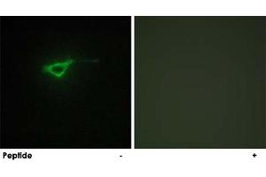 Immunofluorescence analysis of NIH/3T3 cells, using COL20A1 polyclonal antibody .
