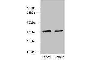 Western blot All lanes: EFNB3 antibody at 1.