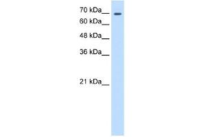WB Suggested Anti-TGM2 Antibody Titration:  0. (Transglutaminase 2 antibody  (N-Term))