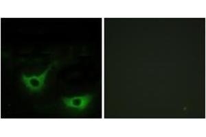 Immunofluorescence analysis of NIH-3T3 cells, using CALR Antibody. (Calreticulin antibody  (AA 21-70))