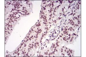 Immunohistochemistry (IHC) image for anti-Multiple Endocrine Neoplasia 1 (MEN1) (AA 392-554) antibody (ABIN2682998)