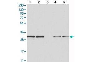 Western blot analysis of Lane 1: RT-4, Lane 2: U-251 MG, Lane 3: Human Plasma, Lane 4: Liver, Lane 5: Tonsil with MAPK1IP1L polyclonal antibody  at 1:250-1:500 dilution. (MAPK1IP1L antibody)