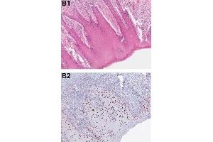 Immunohistochemistry (IHC) image for anti-Programmed Cell Death 4 (PDCD4) (pSer457) antibody (ABIN129708)