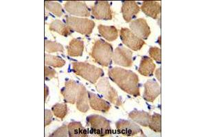 ARL17P1 Antibody immunohistochemistry analysis in formalin fixed and paraffin embedded human skeletal muscle followed by peroxidase conjugation of the secondary antibody and DAB staining.