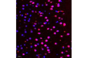 Immunofluorescence of paraffin embedded mouse brain using ALS2CR13 (ABIN7073909) at dilution of 1:650 (400x lens) (FAM117B antibody)