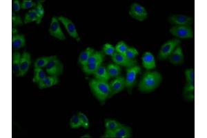 Immunofluorescence staining of HepG2 cells with ABIN7144312 at 1:100, counter-stained with DAPI. (Anoctamin 6 antibody  (AA 12-100))