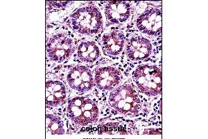 RANG Antibody (N-term) 3776a immunohistochemistry analysis in formalin fixed and paraffin embedded human colon tissue followed by peroxidase conjugation of the secondary antibody and DAB staining. (RANGAP1 antibody  (N-Term))