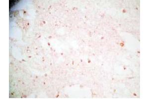 Human brain tissue was stained by Rabbit Anti-Synaptotagminm IV(73-97) (Human) Antibody (SYT4 antibody  (AA 73-97))