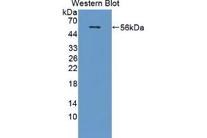 Western blot analysis of the recombinant protein. (X-Ray Repair Cross Complementing 5 (AA 2-460) antibody)