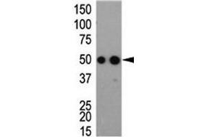 Western blot analysis of HA antibody and tagged recombinant protein bacterial lysate (HA-Tag antibody)