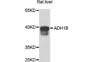 Western blot analysis of extracts of rat liver cells, using ADH1B antibody.