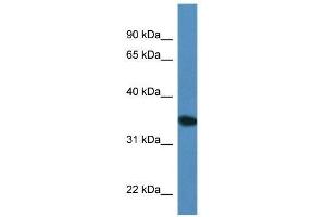 Western Blot showing Upp2 antibody used at a concentration of 1. (UPP2 antibody  (C-Term))
