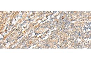 Immunohistochemistry of paraffin-embedded Human tonsil tissue using PCSK5 Polyclonal Antibody at dilution of 1:35(x200) (PCSK5 antibody)