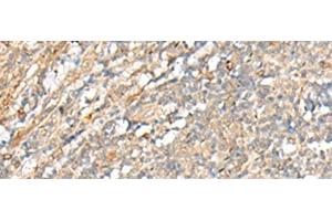 Immunohistochemistry of paraffin-embedded Human tonsil tissue using PCSK5 Polyclonal Antibody at dilution of 1:35(x200)