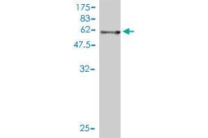 Western Blot detection against Immunogen (57. (APP antibody  (AA 19-305))
