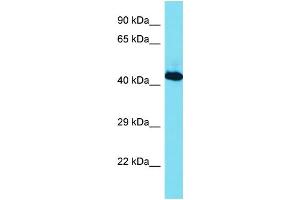 Host: Rabbit Target Name: RBMX Sample Type: Jurkat Whole Cell lysates Antibody Dilution: 1. (RBMX antibody  (C-Term))