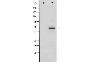 Western blot analysis of CrkII expression in COS7 whole cell lysates,The lane on the left is treated with the antigen-specific peptide. (Crk antibody)