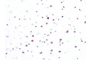 Immunohistochemistry of paraffin-embedded rat brain using PRPF8 Rabbit mAb (ABIN7269737) at dilution of 1:100 (40x lens). (PRPF8 antibody)