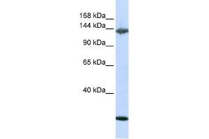 Jagged 2 antibody used at 1 ug/ml to detect target protein. (JAG2 antibody  (N-Term))