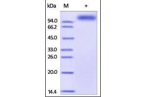Human ALCAM, Fc Tag on SDS-PAGE under reducing (R) condition. (CD166 Protein (AA 28-526) (Fc Tag))