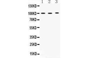 Western blot analysis of ADAM2 expression in rat testis extract ( Lane 1), mouse testis extract ( Lane 2) and MCF-7 whole cell lysates ( Lane 3). (ADAM2 antibody  (N-Term))