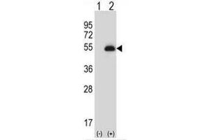 Western blot analysis of PAX6 (arrow) using rabbit polyclonal PAX6 Antibody . (PAX6 antibody)