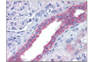 Human Kidney: Formalin-Fixed, Paraffin-Embedded (FFPE) (FAM33A antibody  (N-Term))