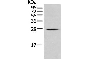 Western blot analysis of K562 cell using MOB1B Polyclonal Antibody at dilution of 1:250 (MOBKL1A antibody)